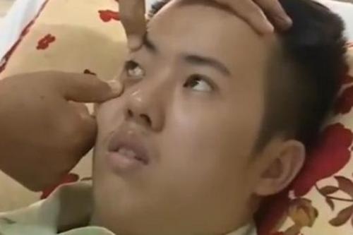 Soc Trang cuu song ca benh hiem gap tren the gioi hinh anh