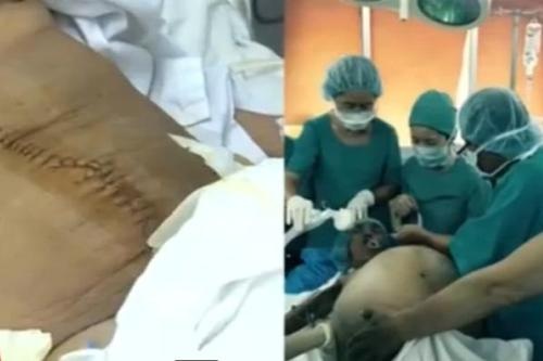 Xuat hien nhieu truong hop khoi u to bat thuong o phu nu hinh anh