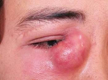 Chay nuoc mat song,vi sao? hinh anh