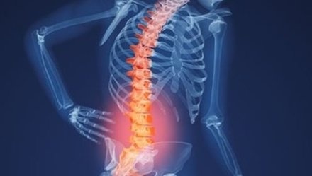 Lan dau tien phau thuat thay than dot song nhan tao hinh anh