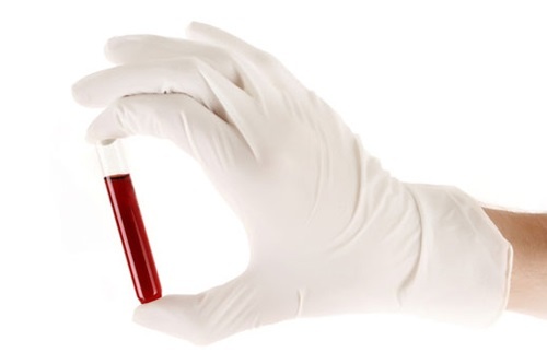 Nhom mau anh huong den benh hinh anh