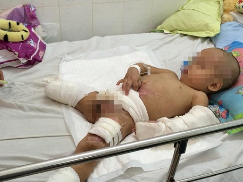 Dieu duong vien quat nat, la loi nguoi nha benh nhan hinh anh