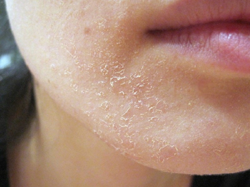 Hong da vi lam dep sai cach hinh anh