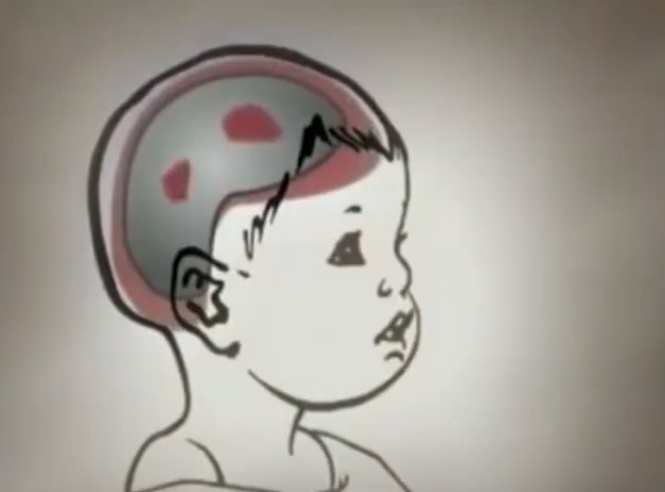 Canh bao ton thuong nao tu viec rung tre duoi 1 tuoi hinh anh