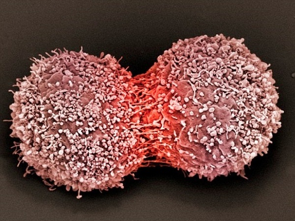 Tim ra 'got chan Achilles' cua can benh ung thu hinh anh