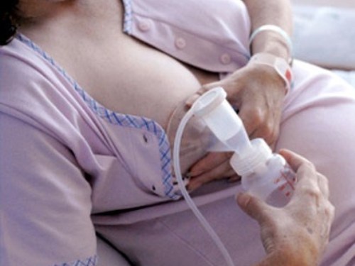 Vat sua non truoc sinh, nguy hiem the nao hinh anh