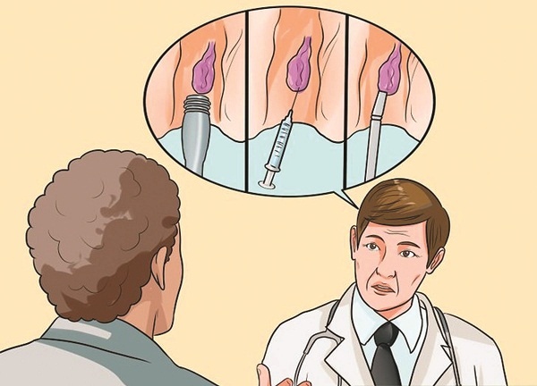 Bệnh trĩ ngoại ảnh 2 Benh tri ngoai anh 2