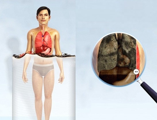 Hút thuốc lá ảnh hưởng đến cơ thể ảnh 2 Hut thuoc la anh huong den co the anh 2