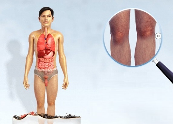 Hút thuốc lá ảnh hưởng đến cơ thể ảnh 5 Hut thuoc la anh huong den co the anh 5
