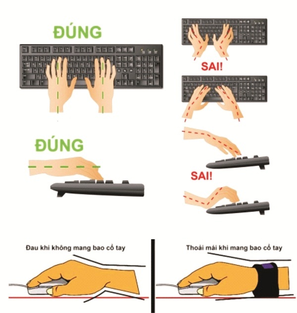 Hội chứng ống cổ tay ảnh 2 Hoi chung ong co tay anh 2
