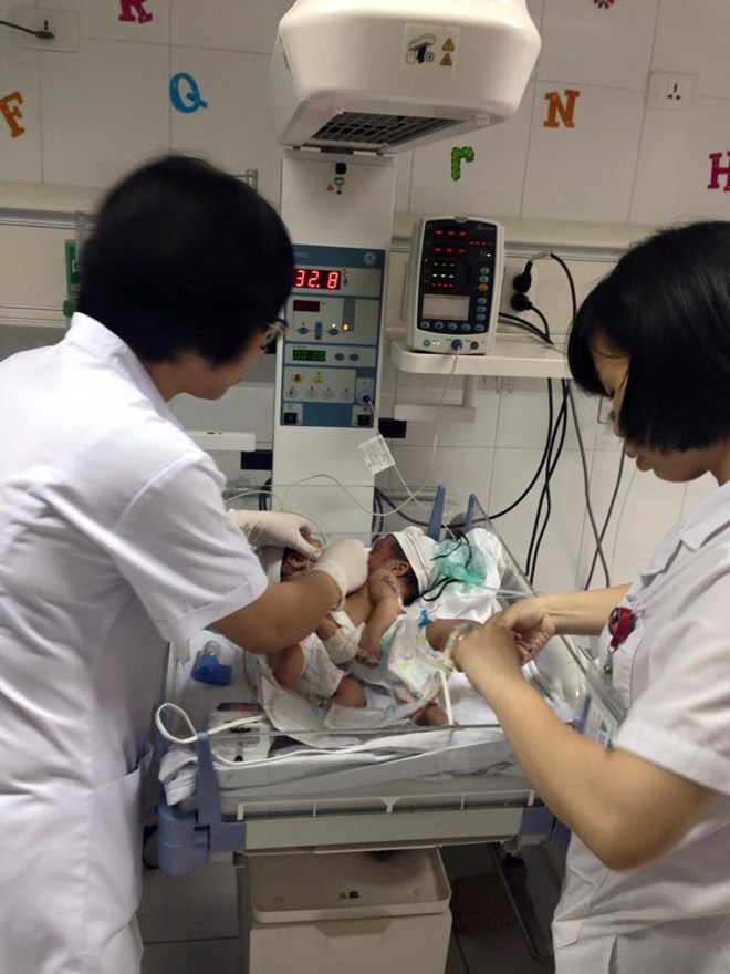 Bác sĩ xin từ thiện cứu 2 bé song sinh dính liền ảnh 3 Bac si xin tu thien cuu 2 be song sinh dinh lien anh 3