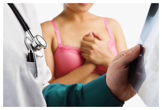 Hieu lam ve ung thu vu anh 1