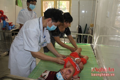 Viêm não mô cầu có thể gây tử vong ảnh 1 Viem nao mo cau co the gay tu vong anh 1