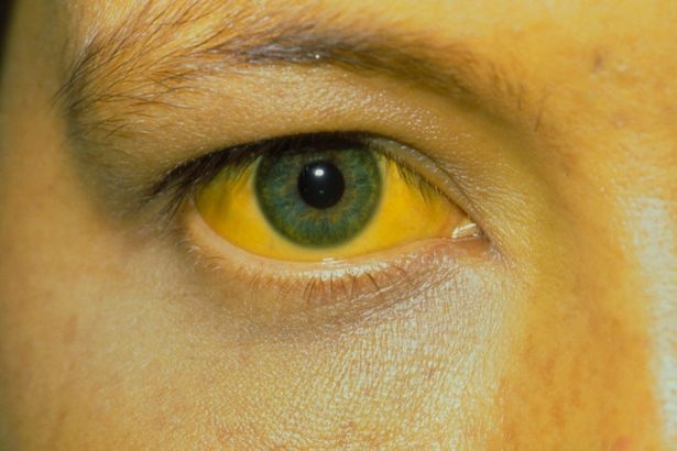 Nhung thay doi tren da canh bao benh anh 1