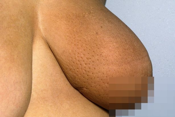 Nhung thay doi tren da canh bao benh anh 2