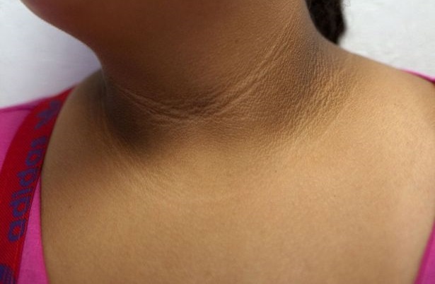 Nhung thay doi tren da canh bao benh anh 3