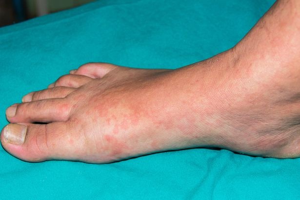 Nhung thay doi tren da canh bao benh anh 4