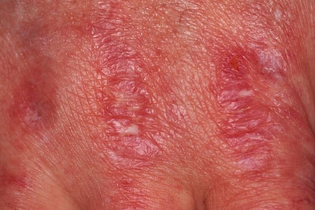 Nhung thay doi tren da canh bao benh anh 5