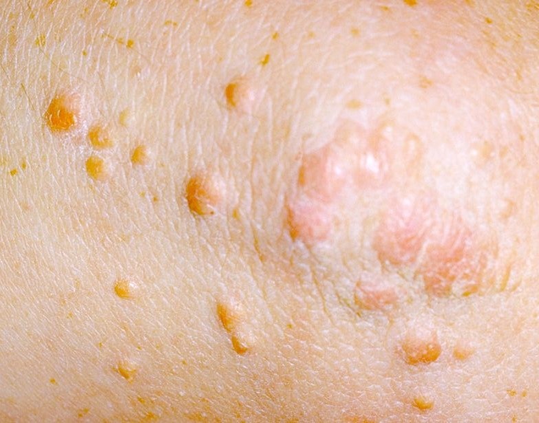 Nhung thay doi tren da canh bao benh anh 7