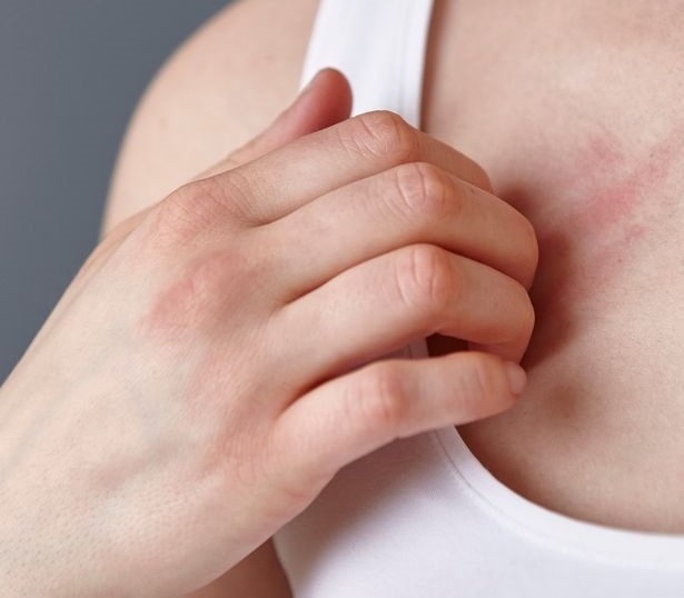 Nhung thay doi tren da canh bao benh anh 8