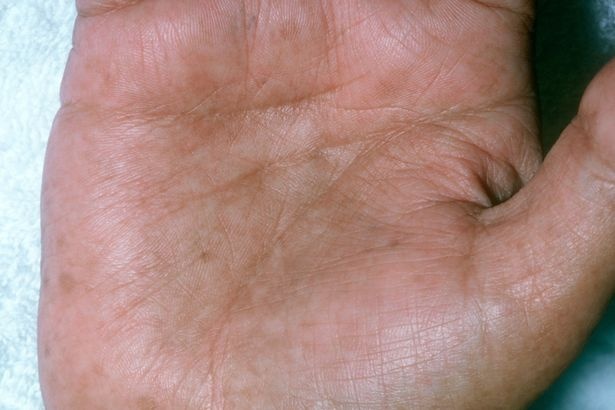 Nhung thay doi tren da canh bao benh anh 9