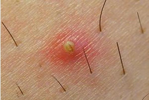 Vấn đề sức khỏe ẩn dưới da ảnh 1 Van de suc khoe an duoi da anh 1