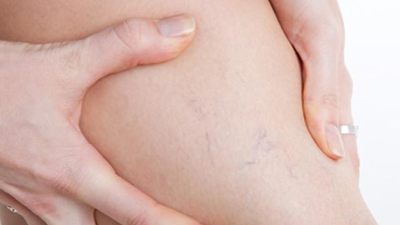 Vấn đề sức khỏe ẩn dưới da ảnh 2 Van de suc khoe an duoi da anh 2