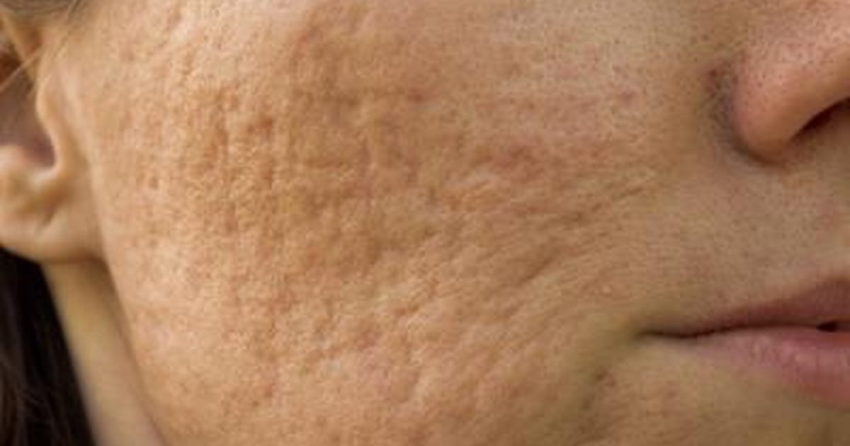 Vấn đề sức khỏe ẩn dưới da ảnh 4 Van de suc khoe an duoi da anh 4