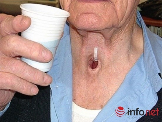 Căn bệnh 'cá nằm trên thớt' ảnh 1 Can benh 'ca nam tren thot' anh 1