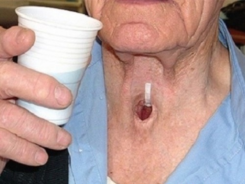 3.000 dong va can benh 'ca nam tren thot' hinh anh