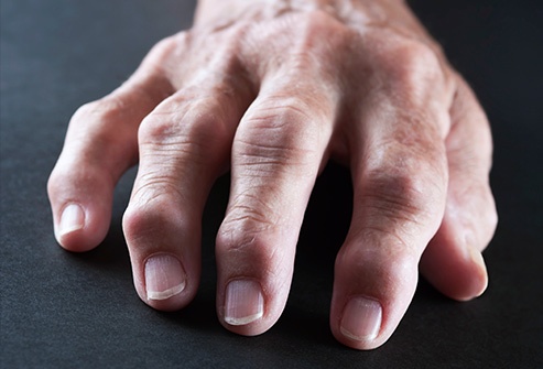 Cac bo phan co the bi tan pha boi thuoc la anh 1