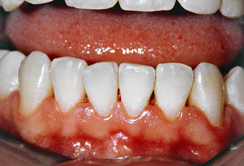 Cac bo phan co the bi tan pha boi thuoc la anh 4