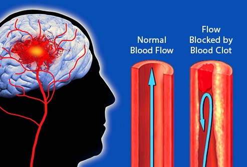 Cac bo phan co the bi tan pha boi thuoc la anh 6