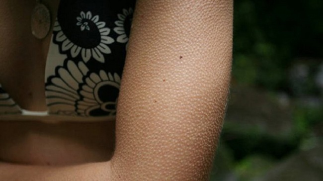 Phan ung ky la cua co the ban khong the kiem soat anh 6