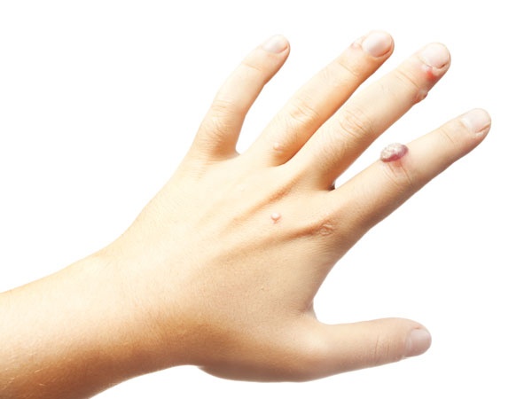 Tac hai cua thuoc la toi ve ngoai anh 4