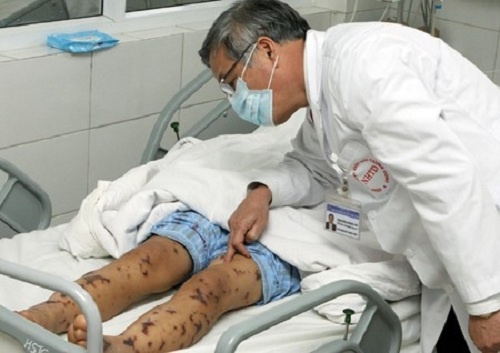 Ha Noi: Nu sinh 18 tuoi hon me vi nhiem nao mo cau hinh anh