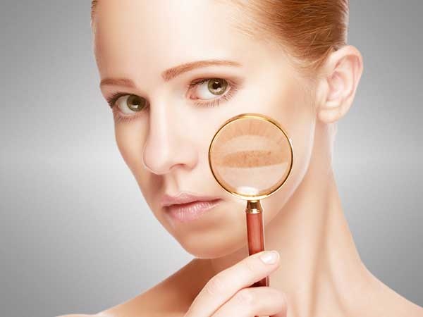 Dau hieu co the thua axit anh 5