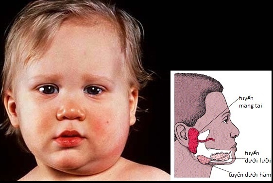 Tre bi quai bi, lon de vo sinh hinh anh