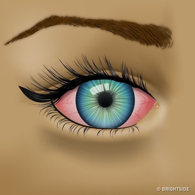 Dau hieu bat thuong o mat anh 3