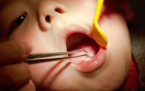 Be gai suyt mat mang vi co giao loi chiec thia hoc o co hong hinh anh