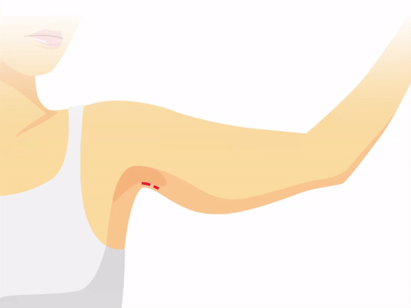 Bai tap giam mo bap tay hieu qua hinh anh