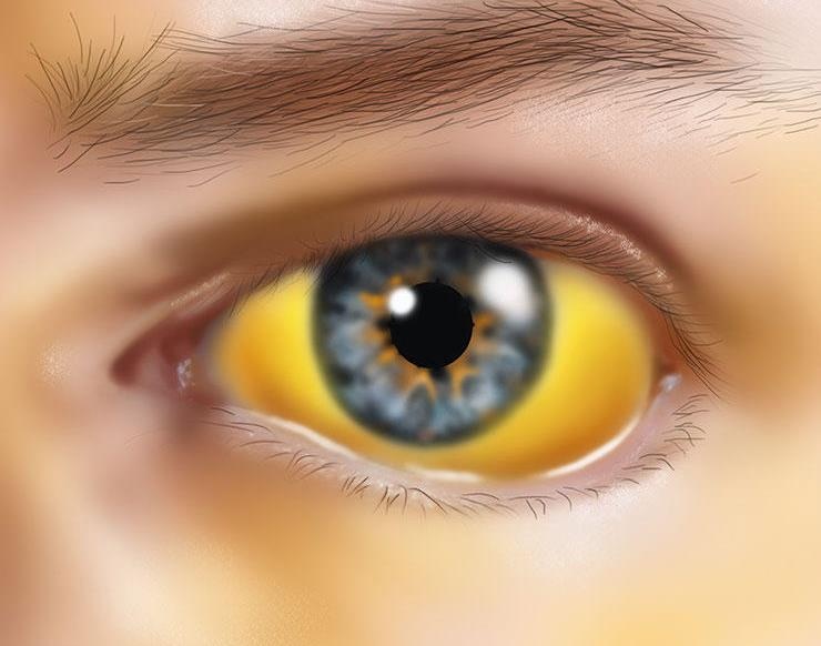 Dau hieu gan yeu anh 2