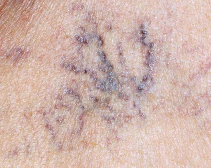 Dau hieu gan yeu anh 4