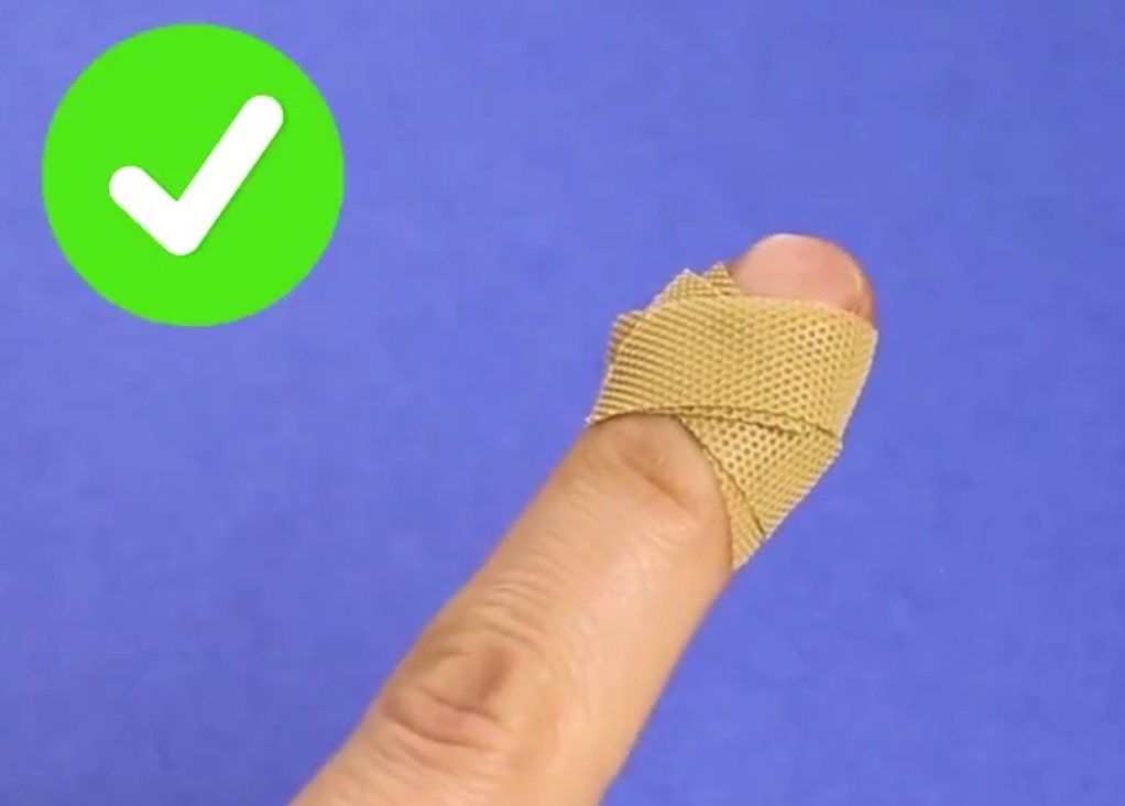 Cach bang bo vet thuong mau lanh hinh anh