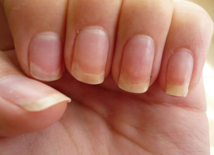 Dau hieu mong tay canh bao co the co van de hinh anh