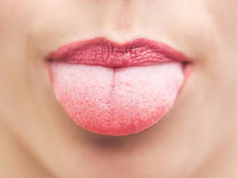 8 dau hieu thay doi o luoi canh bao suc khoe co van de hinh anh