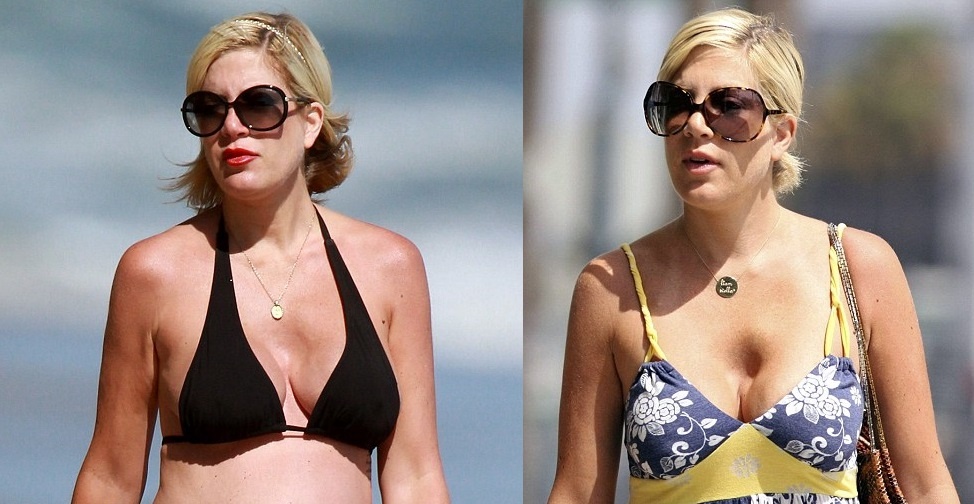 Sao quoc te phau thuat nguc hong anh 1