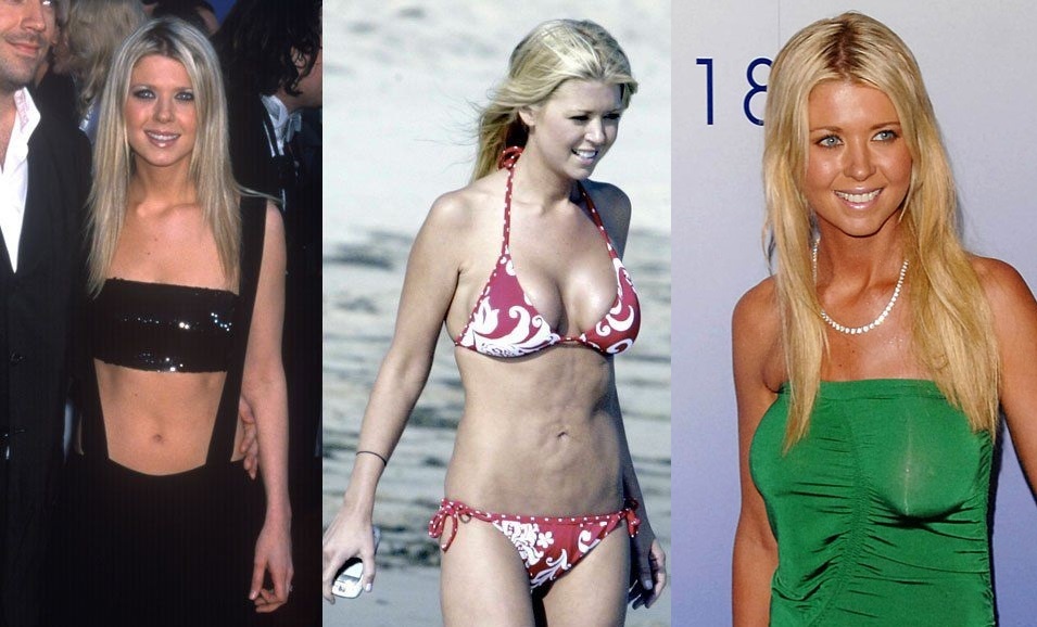 Sao quoc te phau thuat nguc hong anh 2