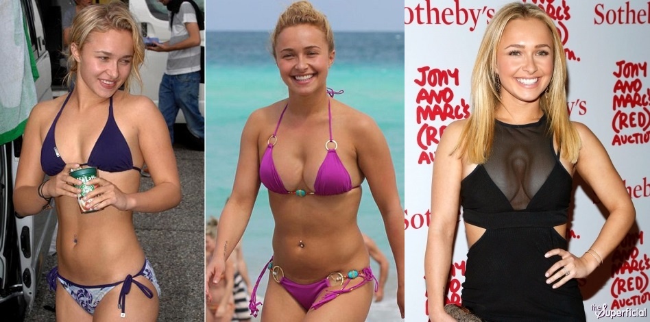 Sao quoc te phau thuat nguc hong anh 5