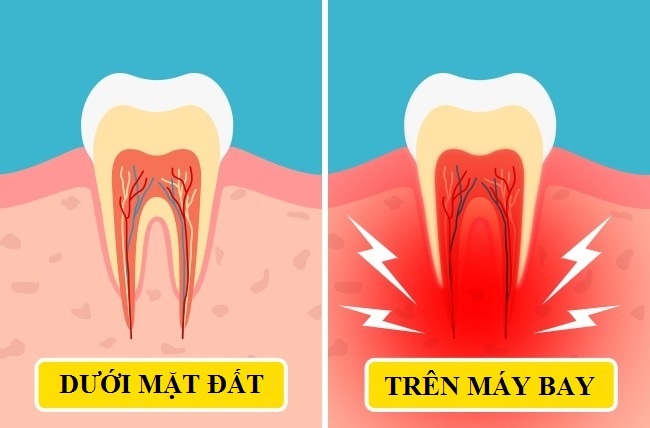 Co the thay doi khi di may bay anh 8